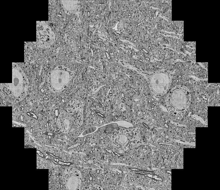 multi-beam_mouse-brain